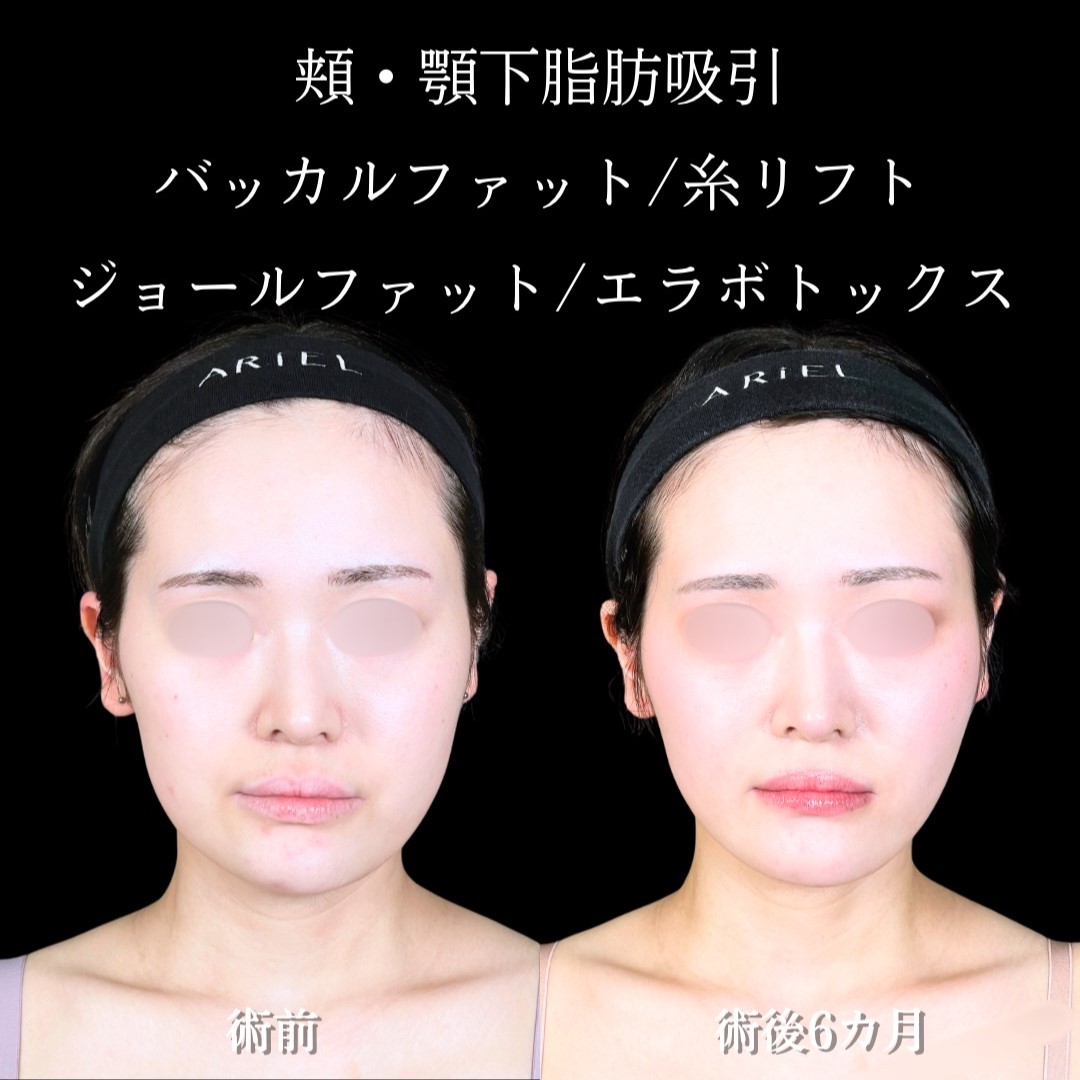 No.18819の症例写真1