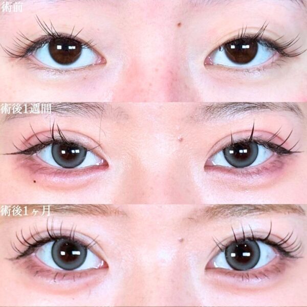 No.18530の症例写真