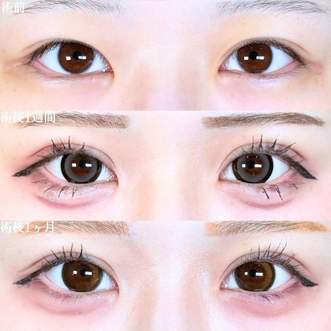 No.18805の症例写真