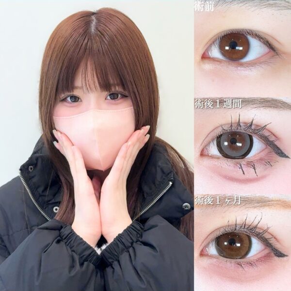 No.18840の症例写真