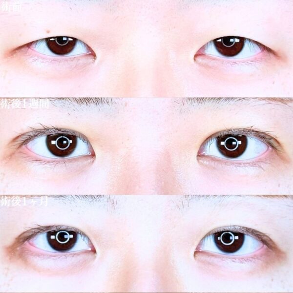 No.18920の症例写真