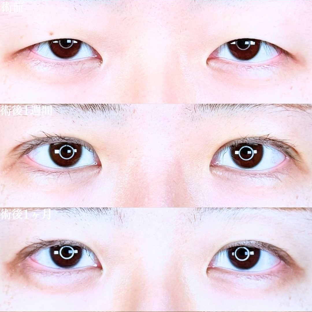 No.18920の症例写真