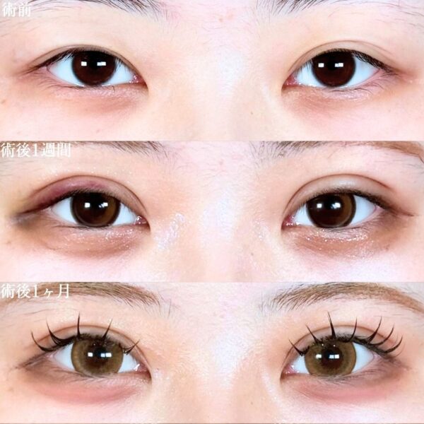 No.18934の症例写真