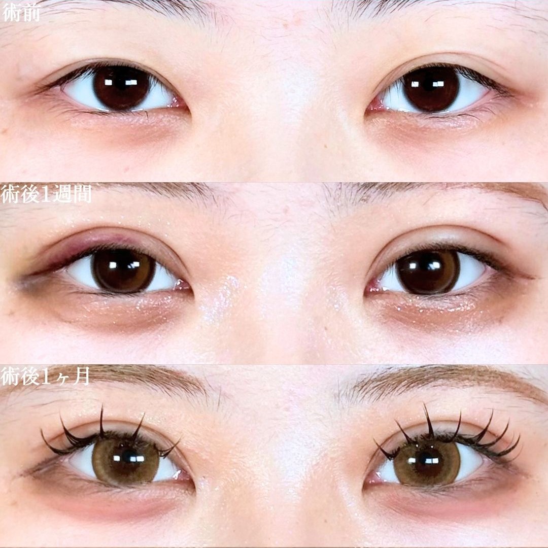 No.18934の症例写真