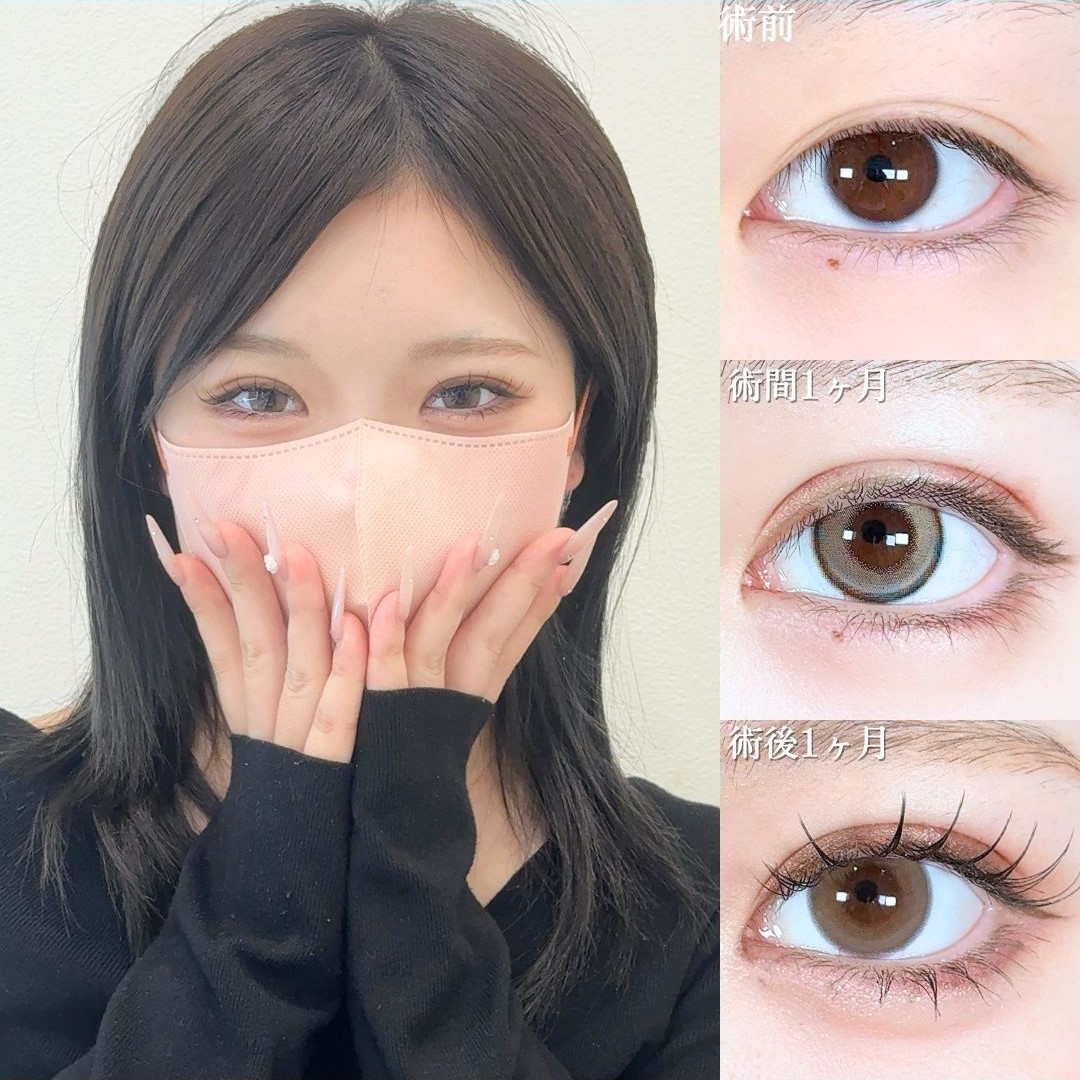 No.18961の症例写真