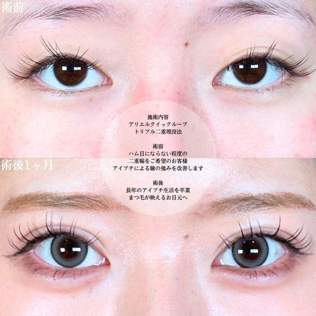 No.18530の症例写真1