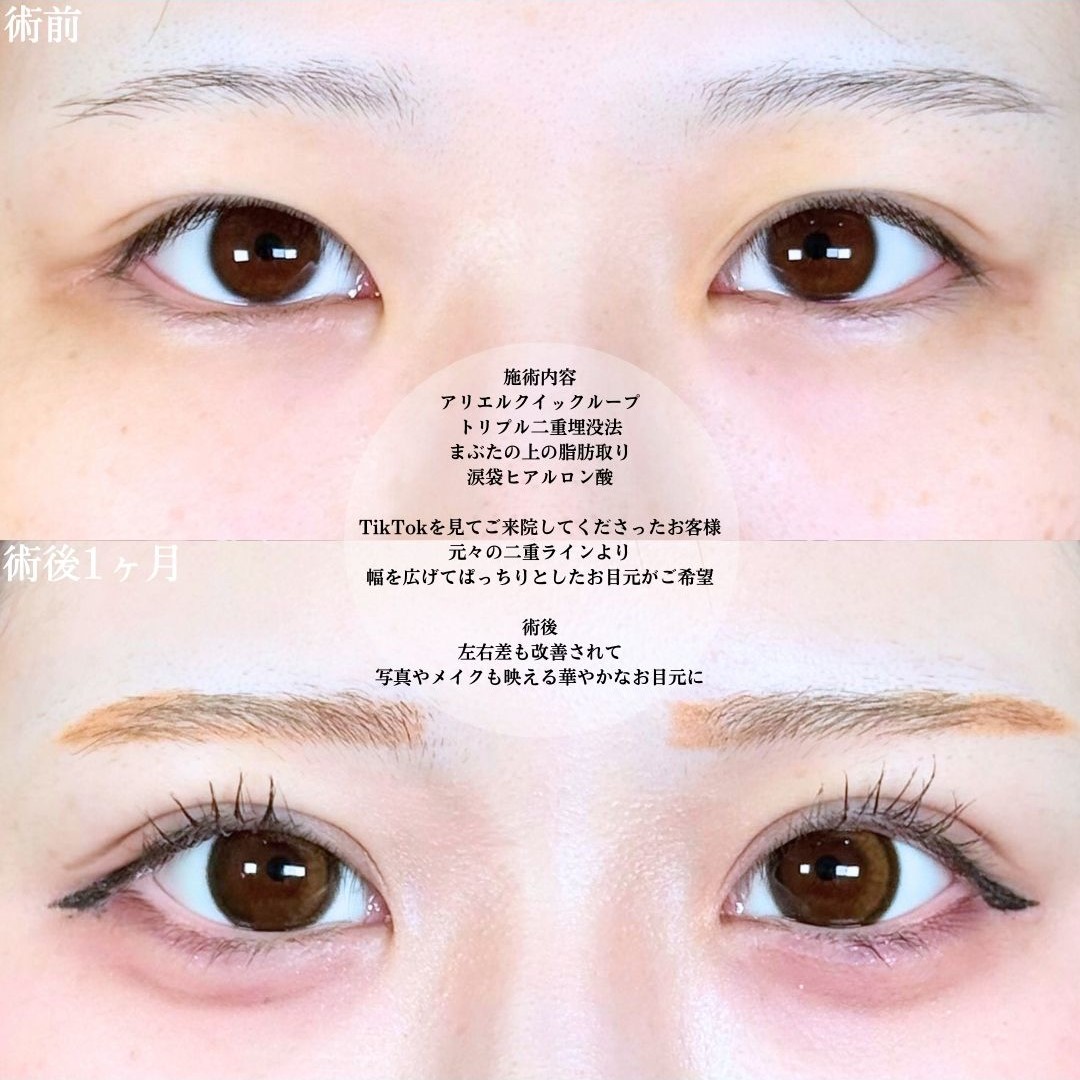 No.18805の症例写真1