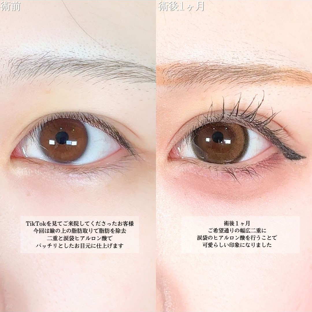 No.18840の症例写真1