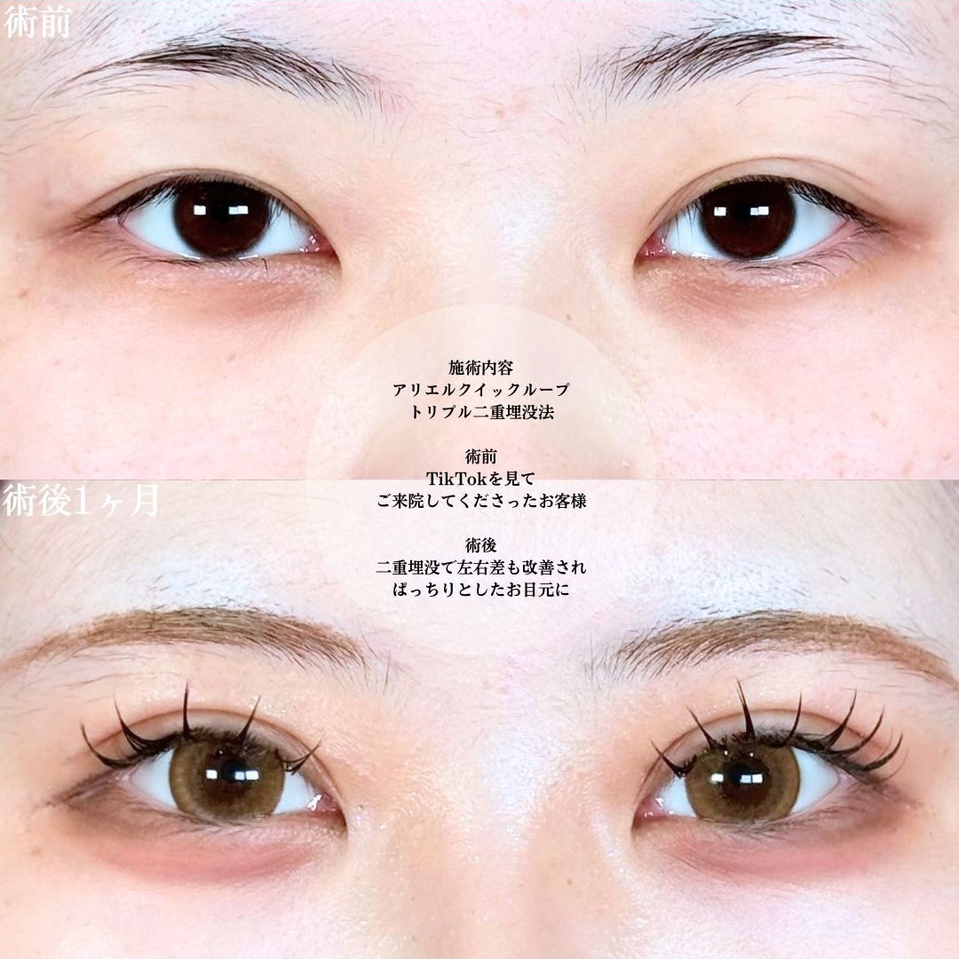 No.18934の症例写真1