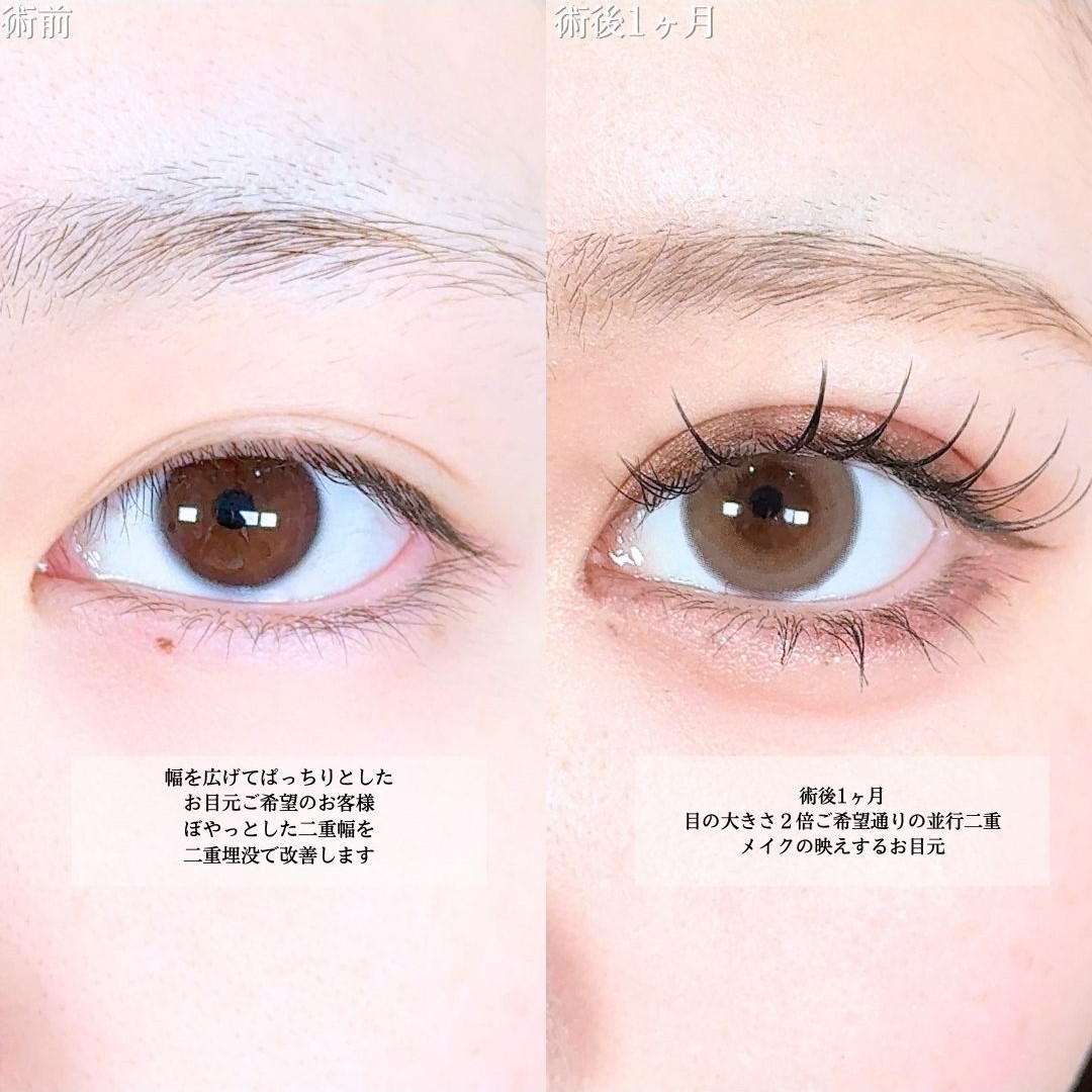 No.18961の症例写真1