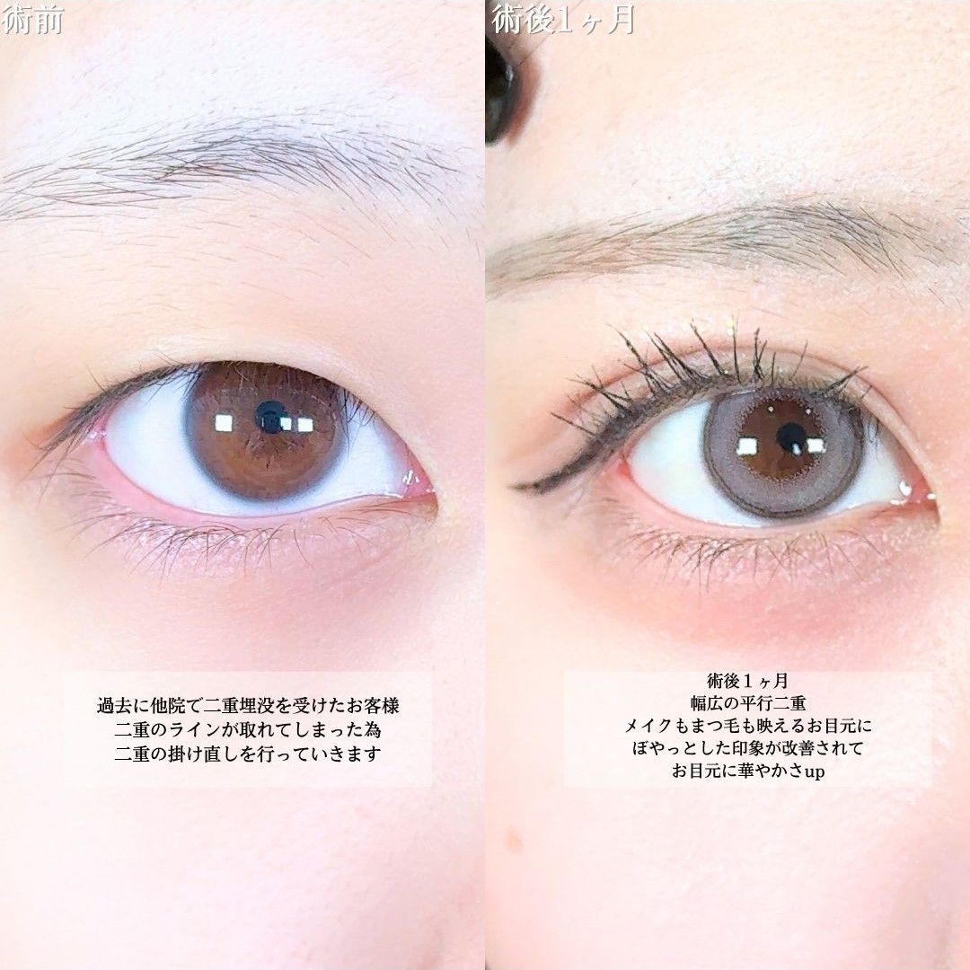 No.18645の症例写真1