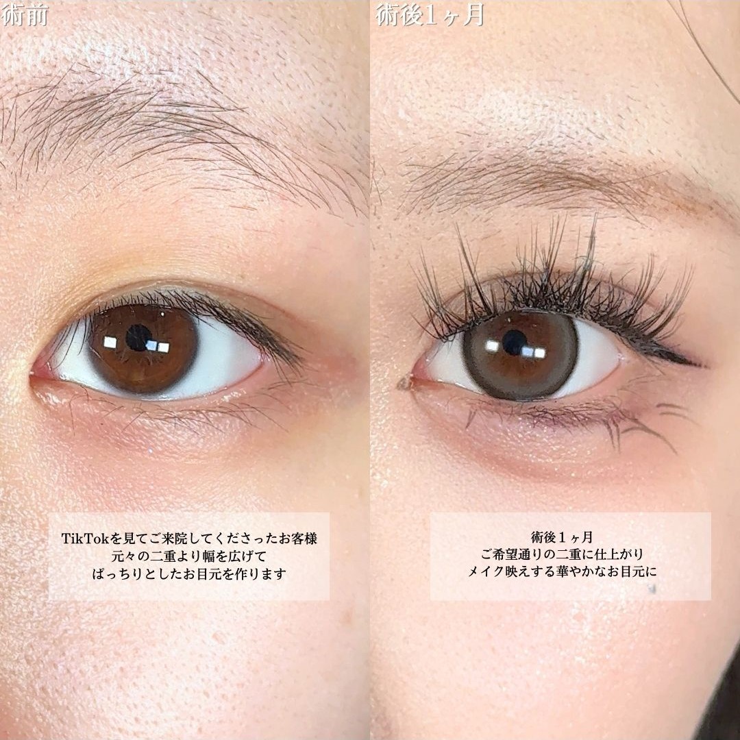 No.18797の症例写真1