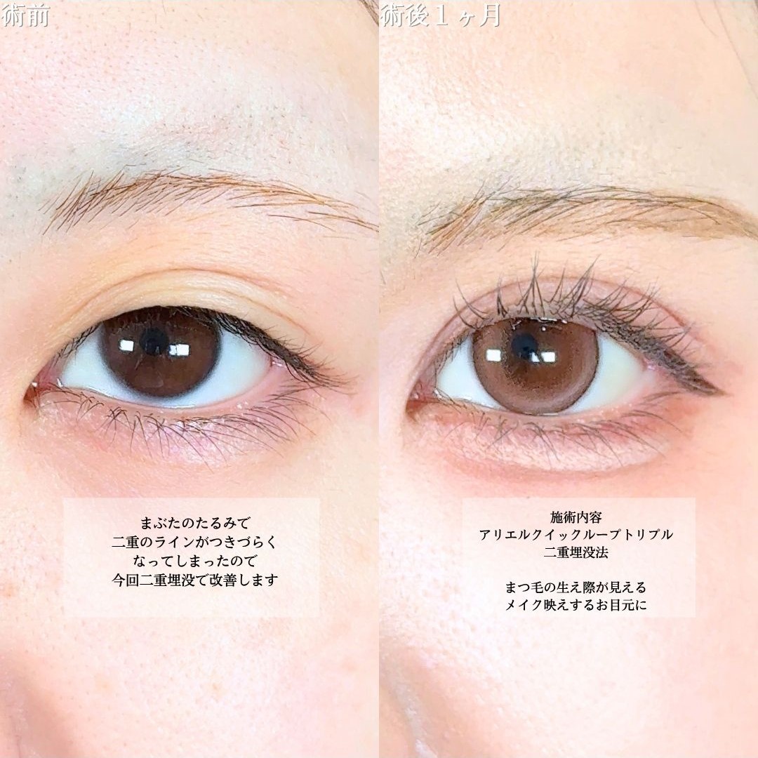 No.18509の症例写真1