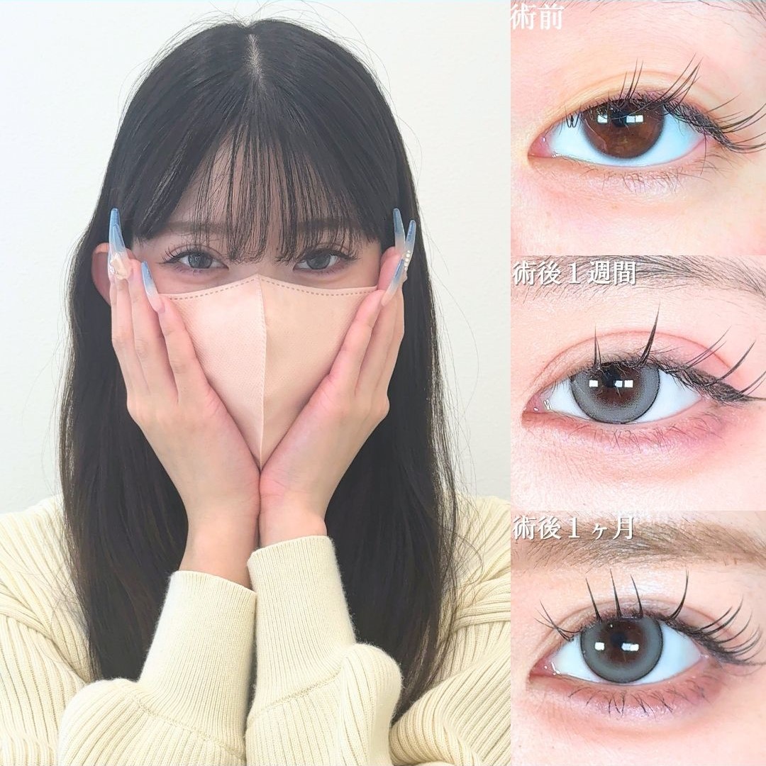 No.18563の症例写真