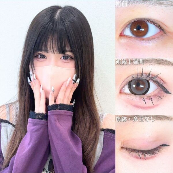 No.18588の症例写真 No.18588の症例写真