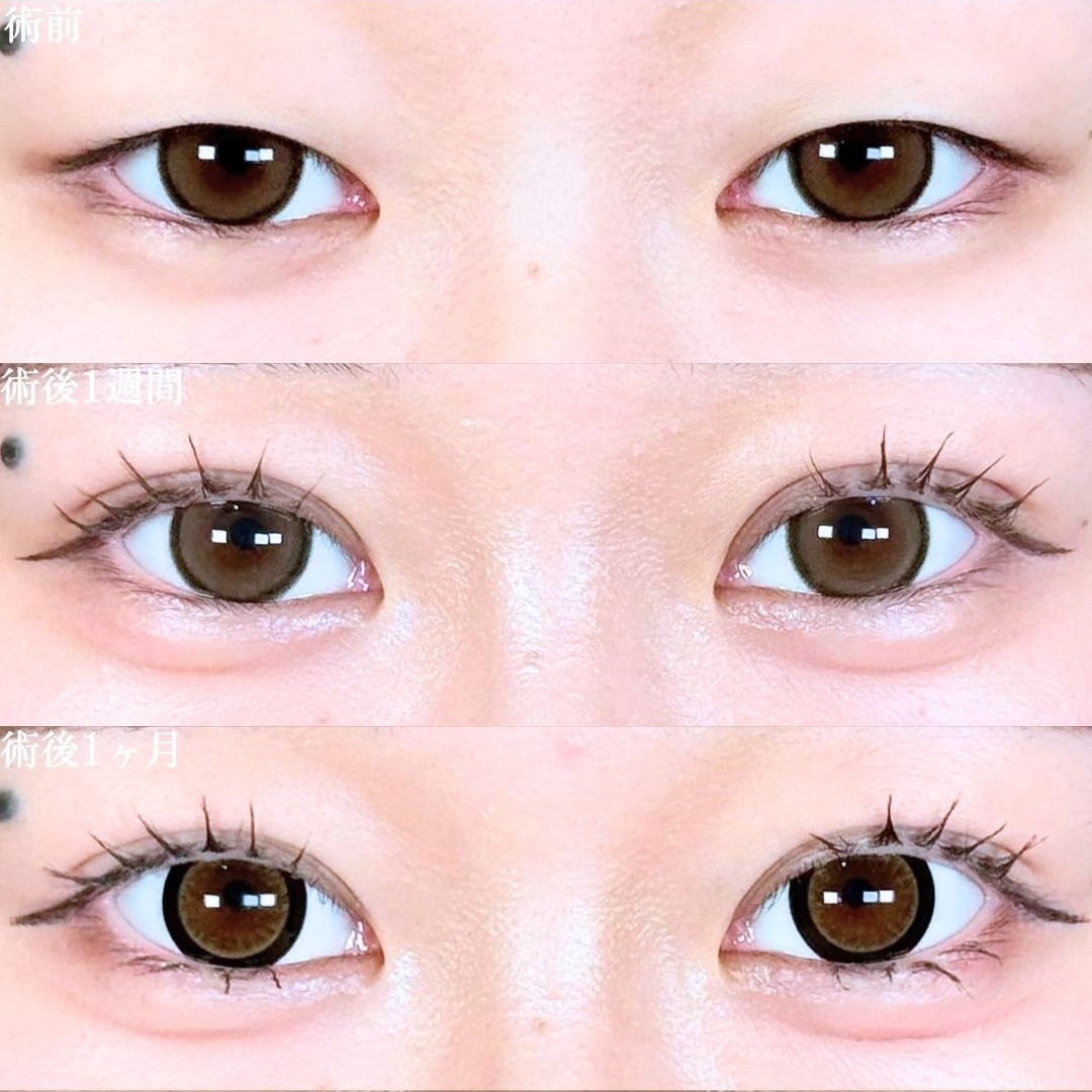 No.18621の症例写真