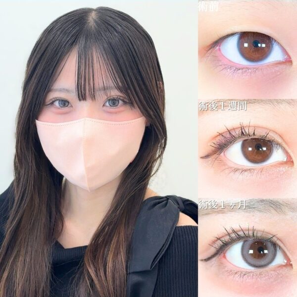 No.18645の症例写真 No.18645の症例写真