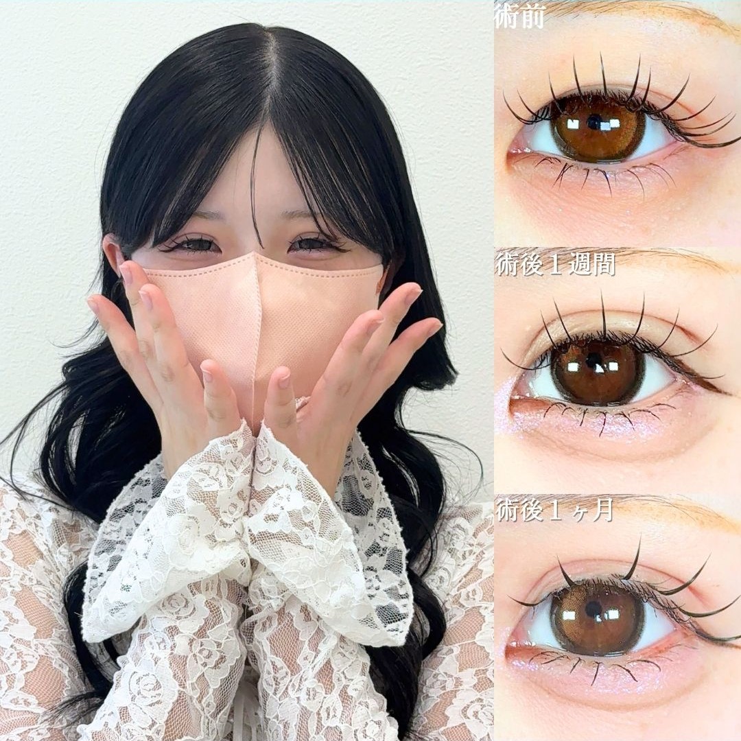 No.18678の症例写真