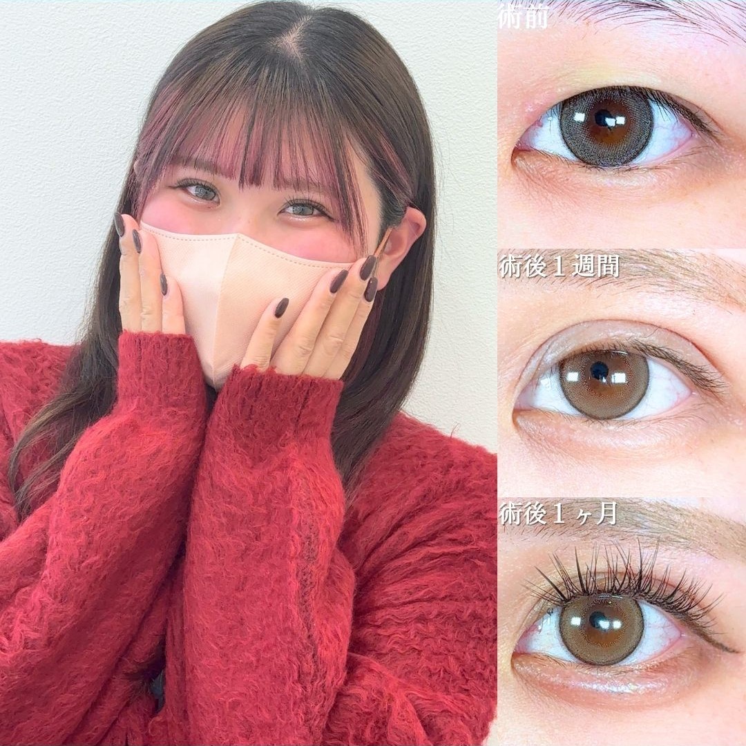 No.18759の症例写真