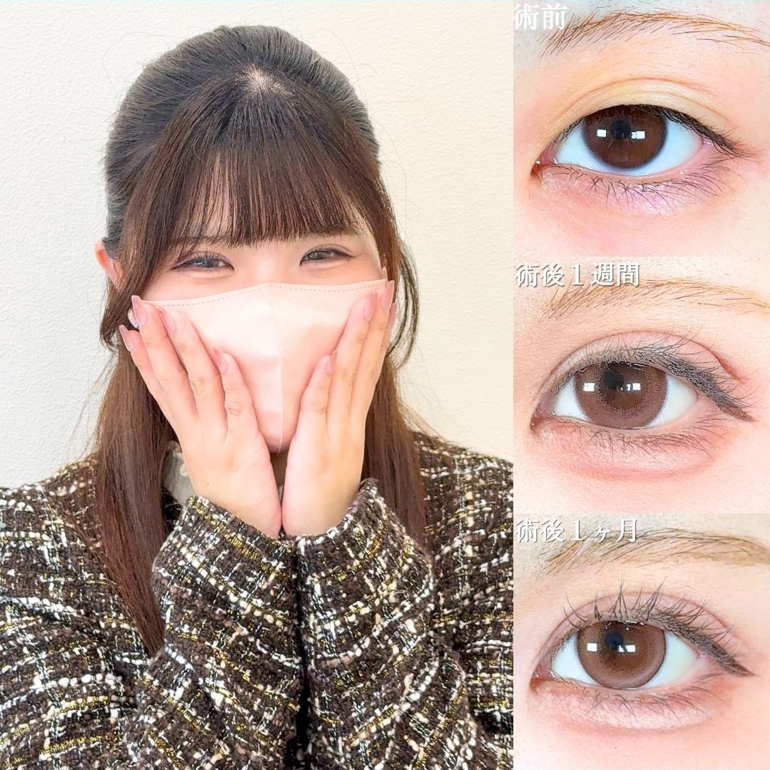 No.18509の症例写真