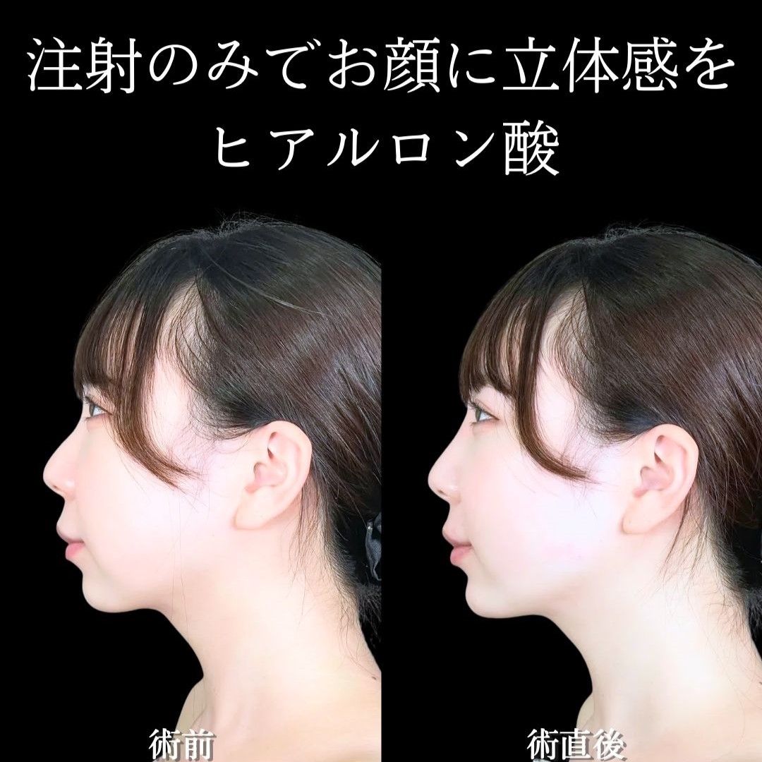 No.19303の症例写真