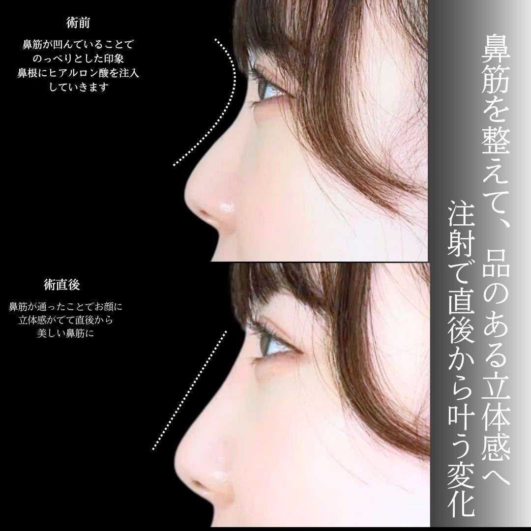 No.19303の症例写真1