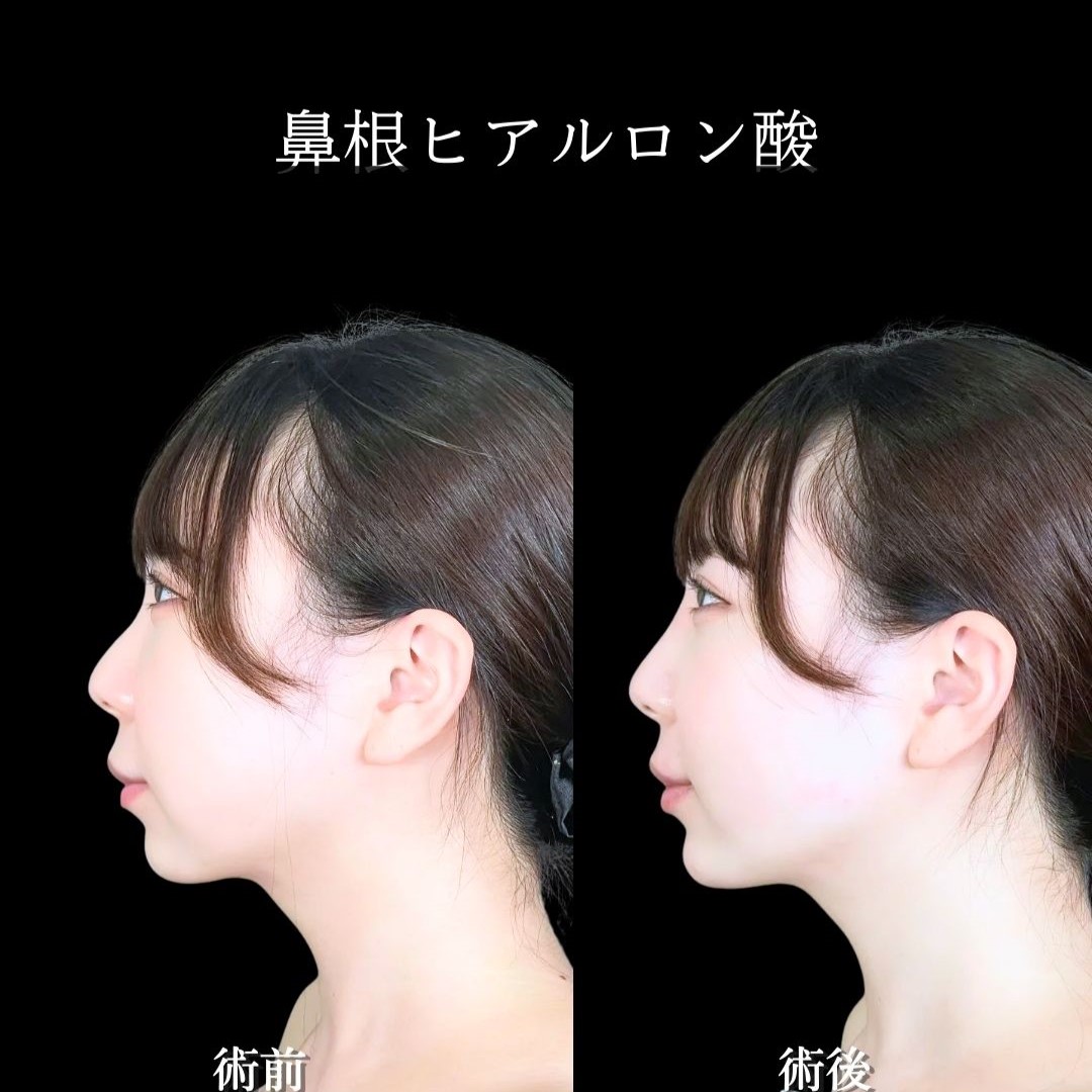 No.19303の症例写真2