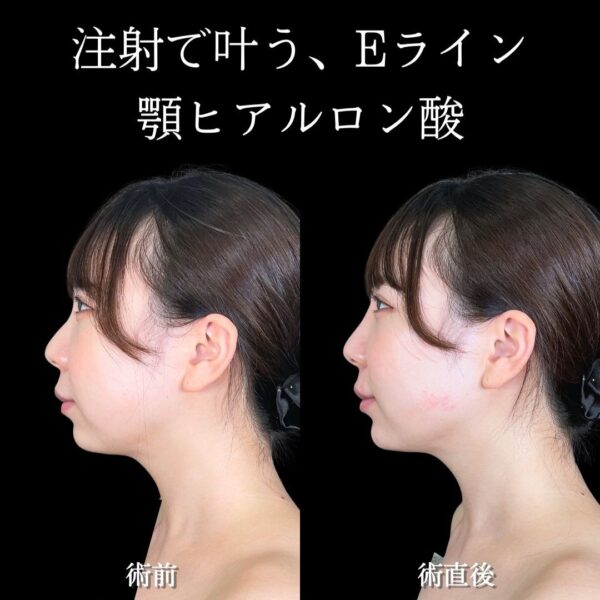 No.19020の症例写真