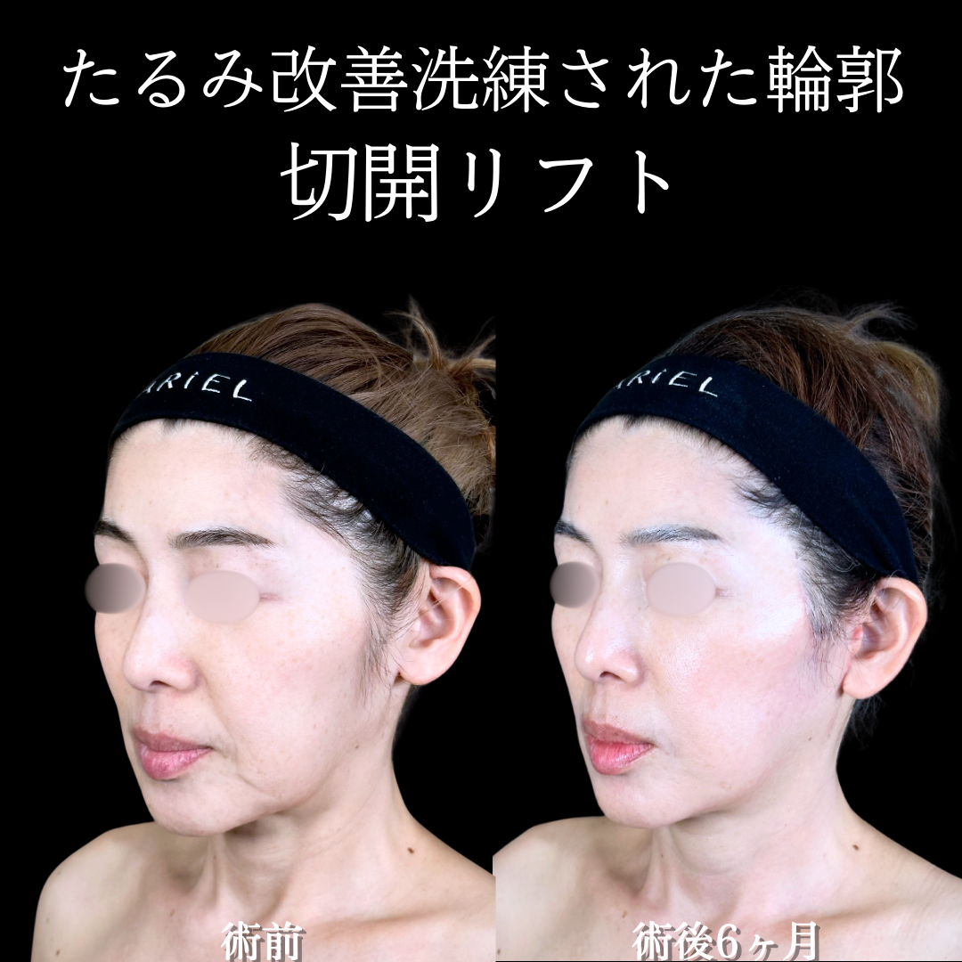 No.19076の症例写真