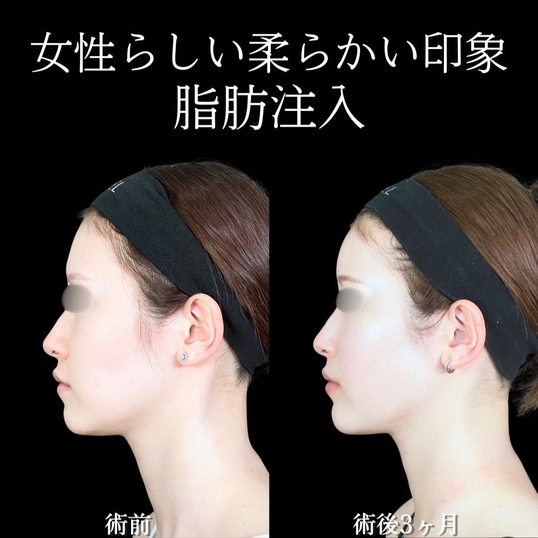 No.19316の症例写真