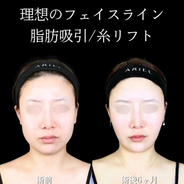 No.19058の症例写真