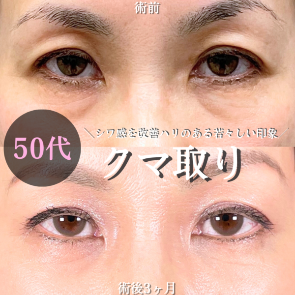 No.19228の症例写真