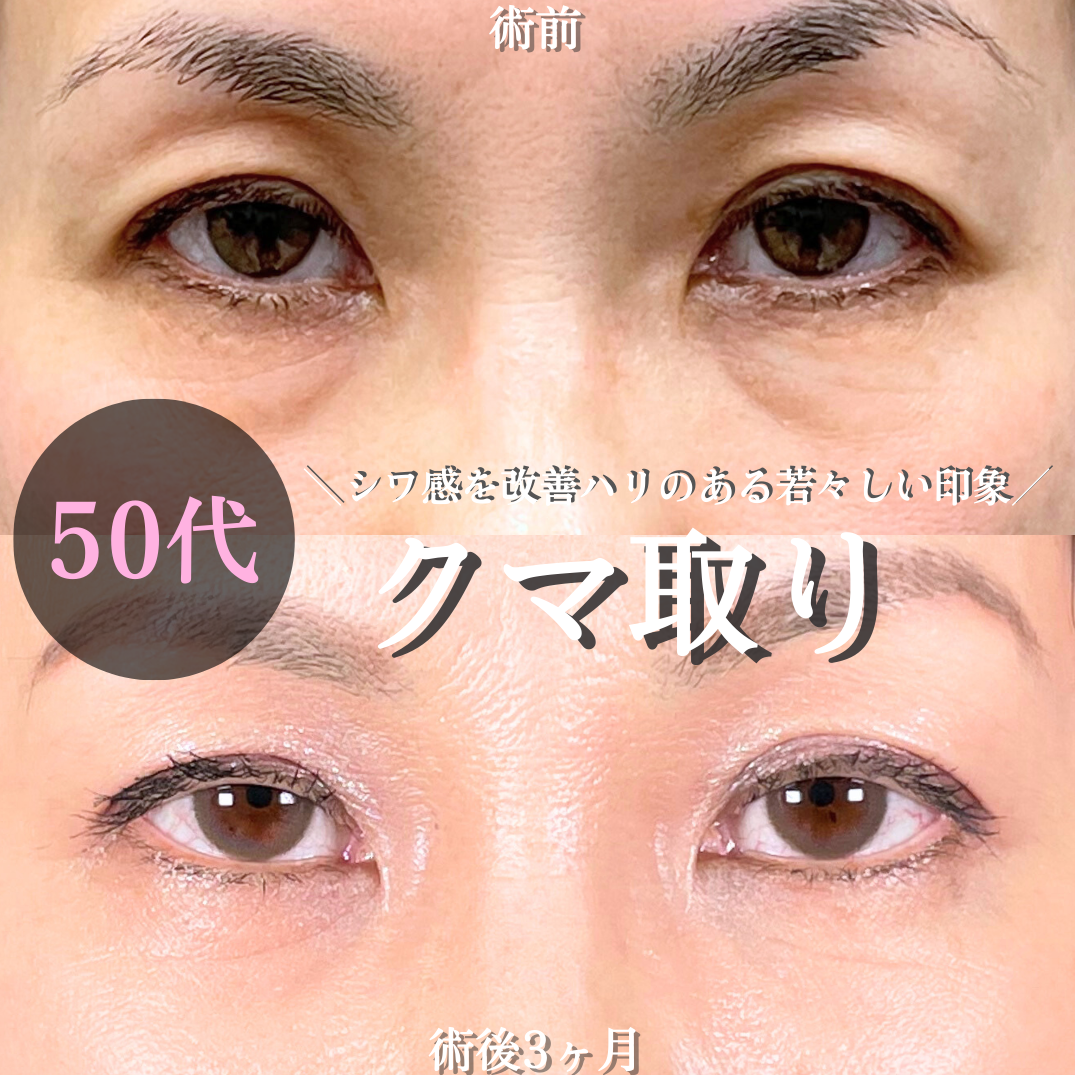 No.19228の症例写真