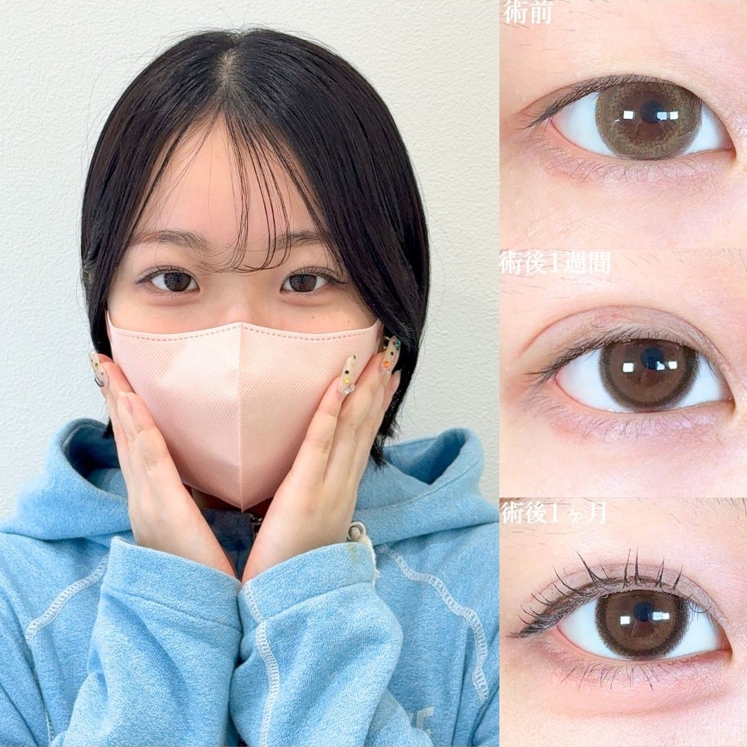 No.19092の症例写真