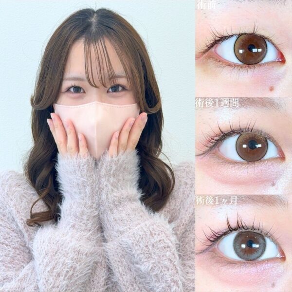 No.19139の症例写真 No.19139の症例写真