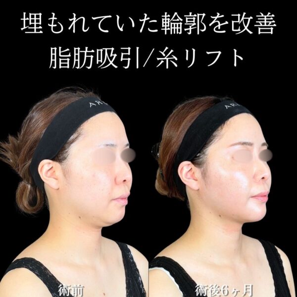 No.19147の症例写真