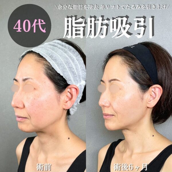 No.19252の症例写真 No.19252の症例写真