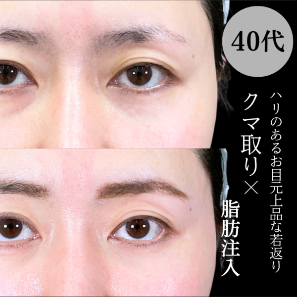 No.19065の症例写真