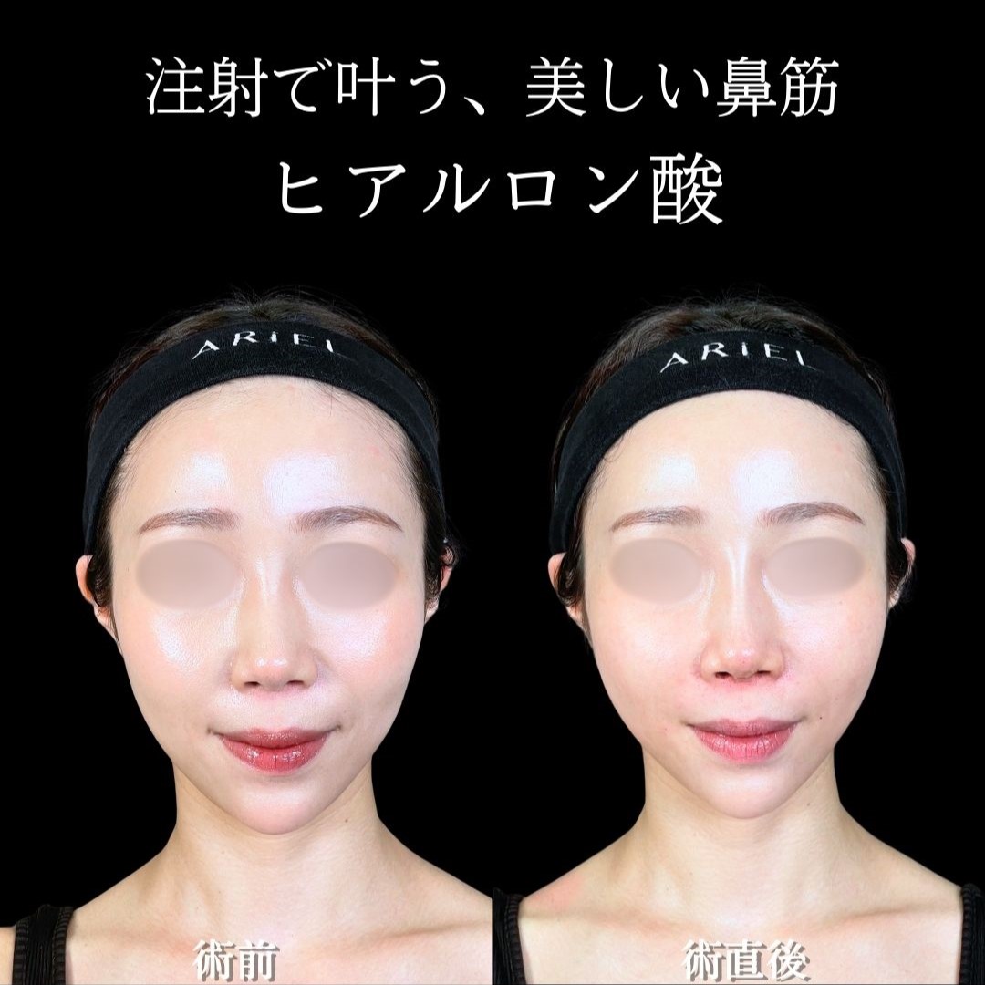 No.19273の症例写真