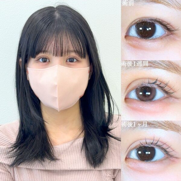 No.19281の症例写真 No.19281の症例写真