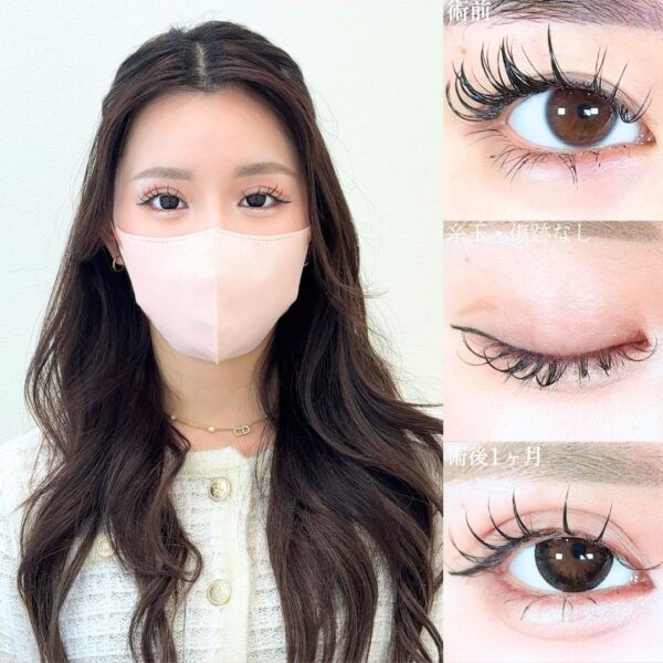 No.19310の症例写真 No.19310の症例写真