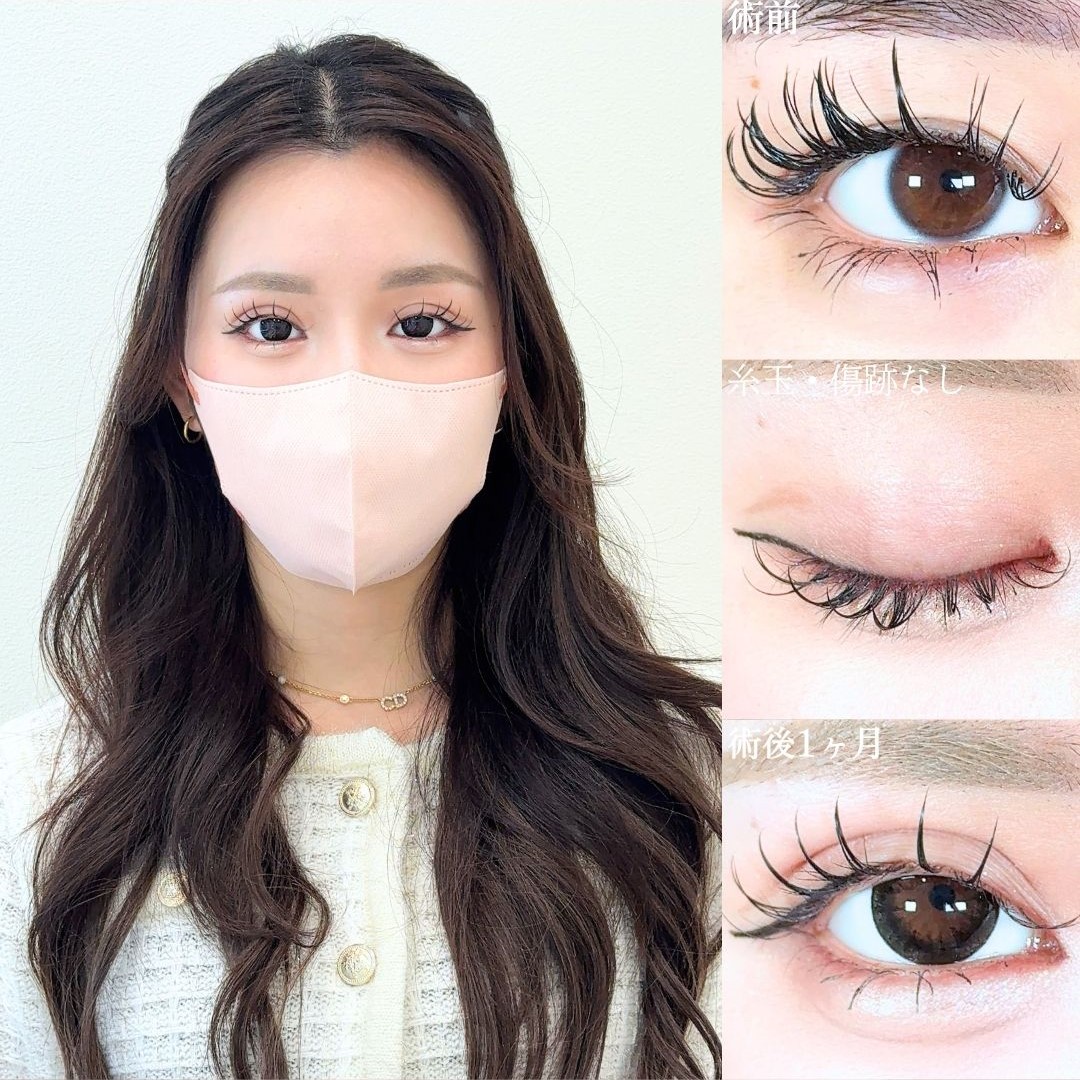 No.19310の症例写真