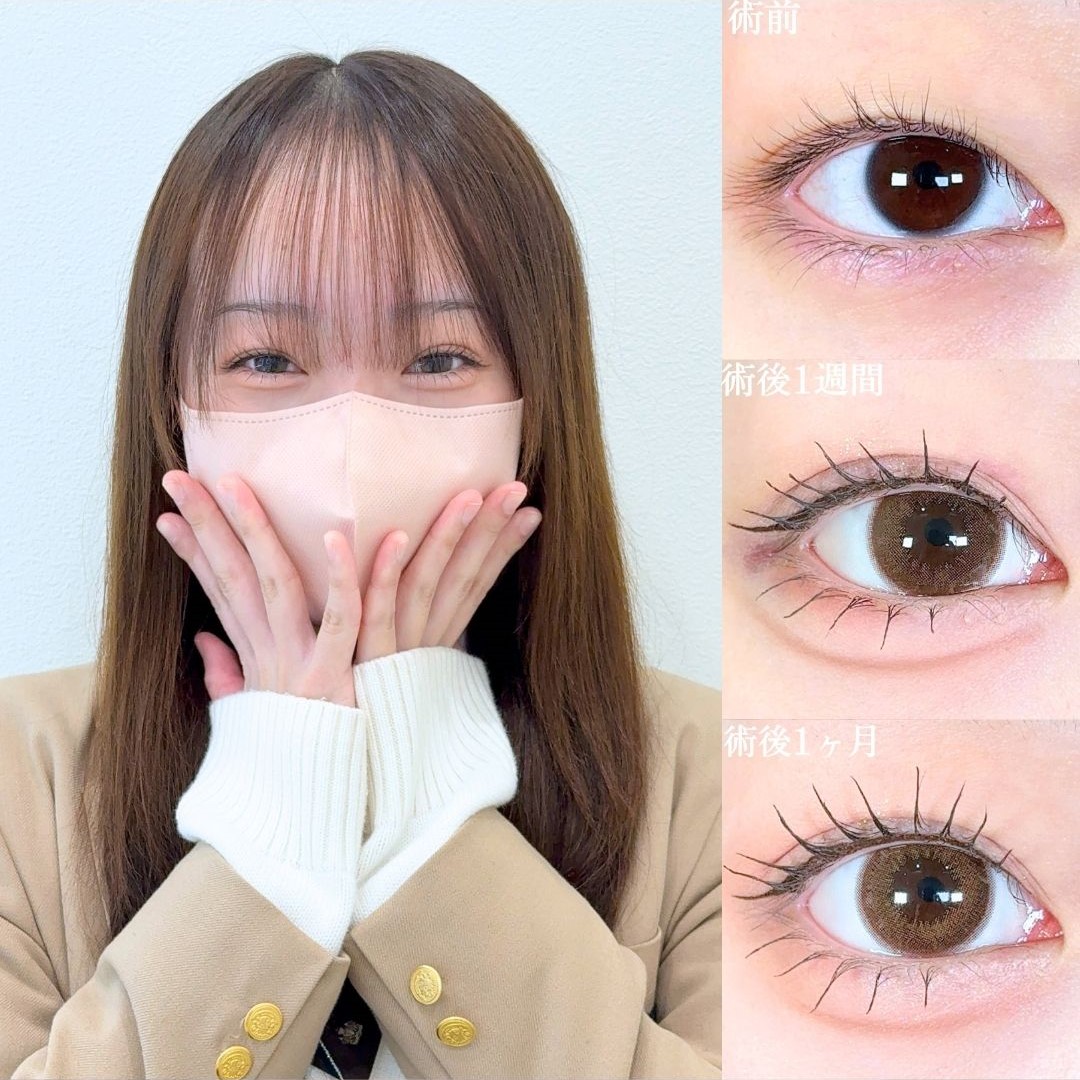 No.18990の症例写真