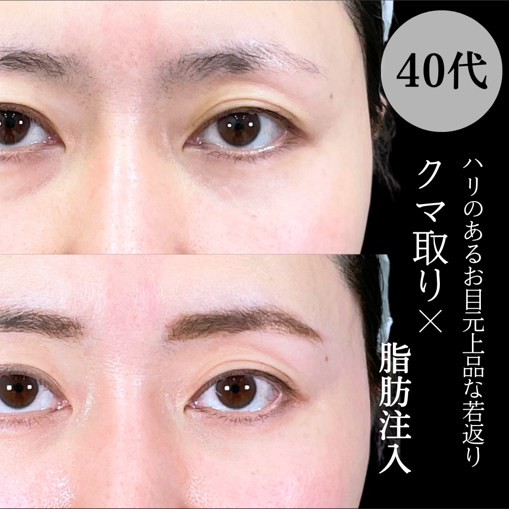 No.19065の症例写真