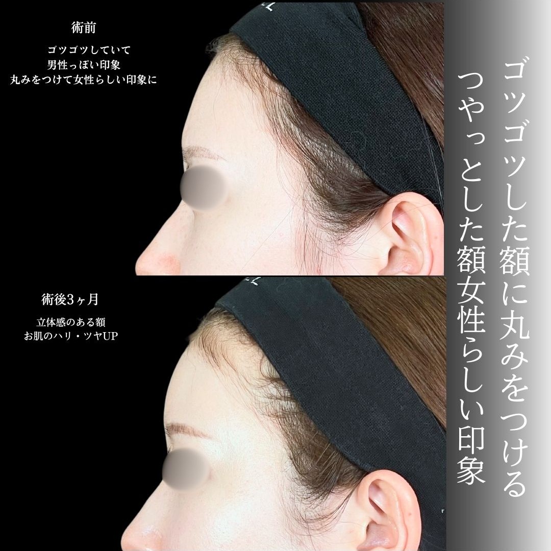 No.19316の症例写真1