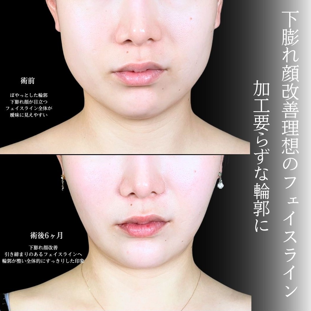 No.19058の症例写真1