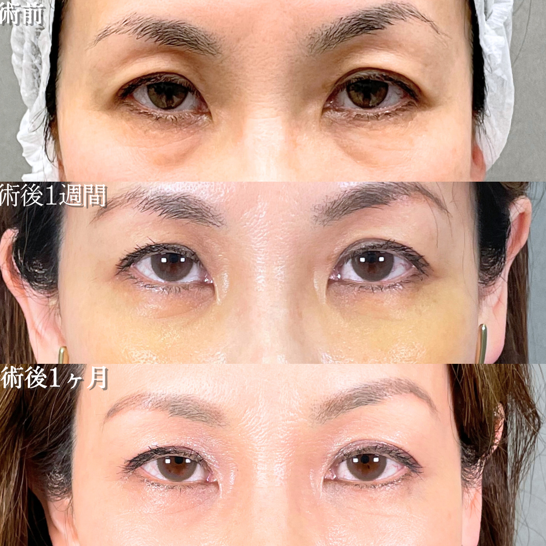 No.19228の症例写真1