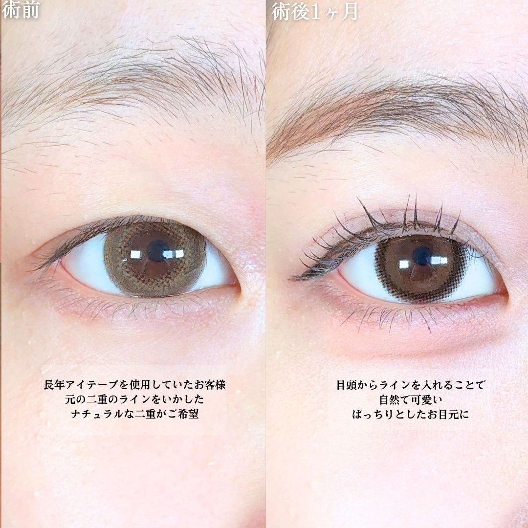 No.19092の症例写真1