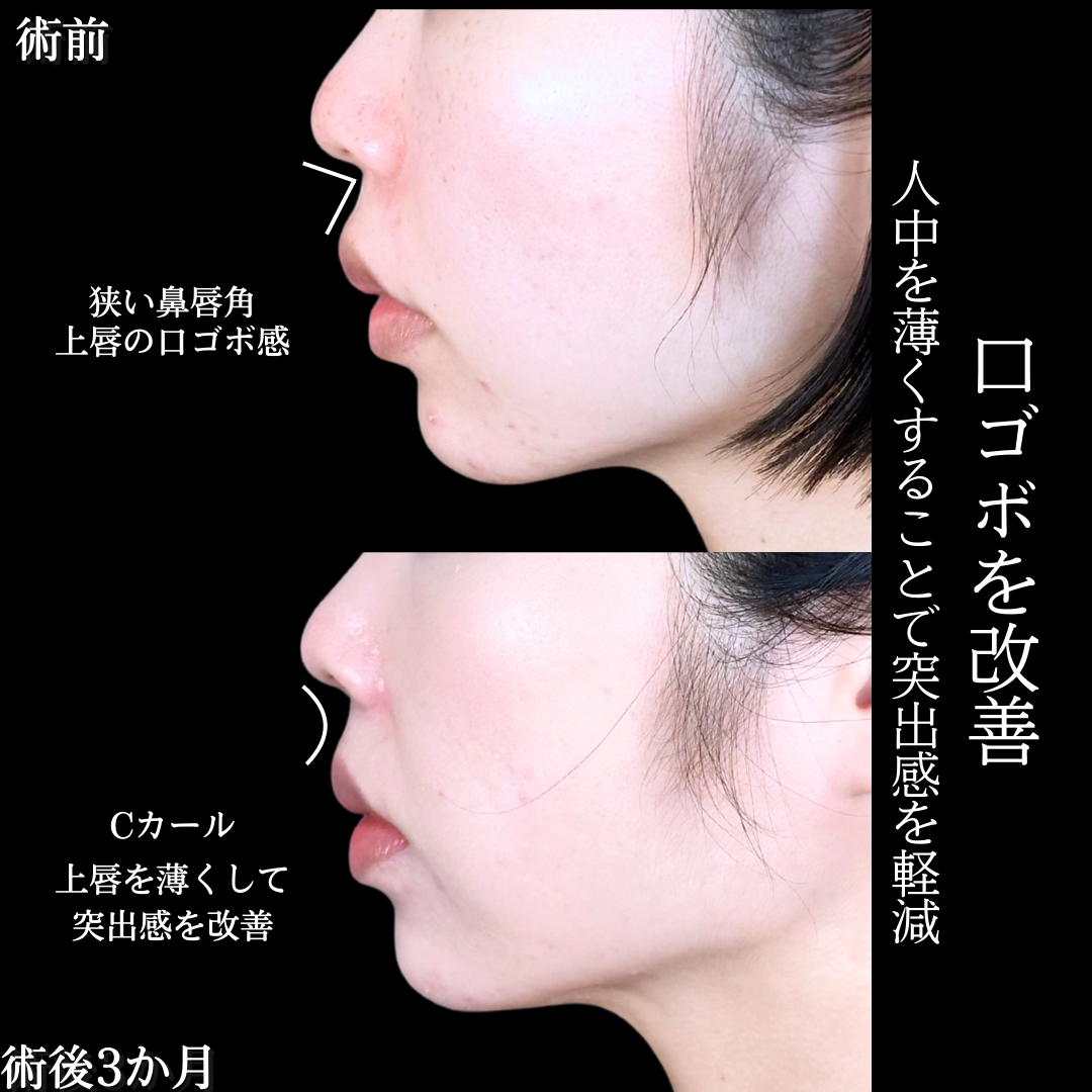 No.19331の症例写真2