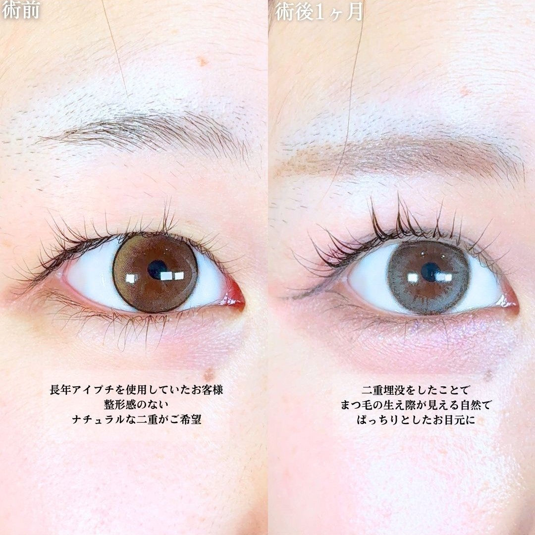 No.19139の症例写真1